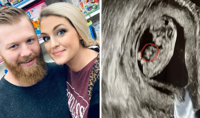 MÃ£e tem bebÃª curado no prÃ³prio Ãºtero apÃ³s oraÃ§Ãµes diÃ¡rias